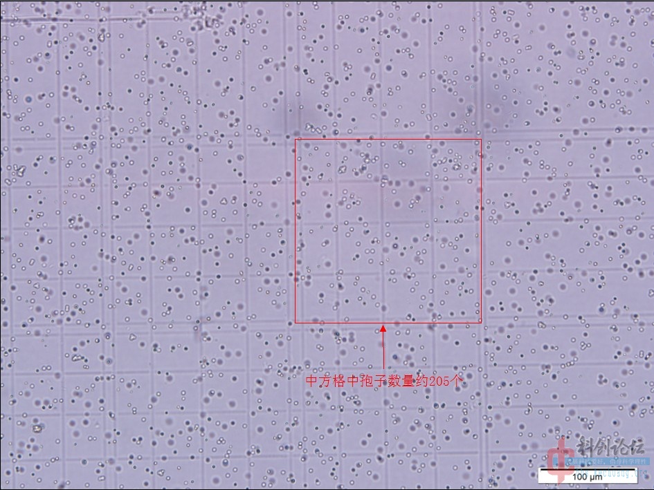 牛鲍氏计数板红细胞图片
